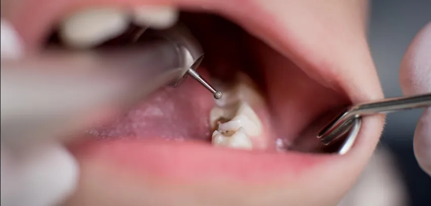 endodontia