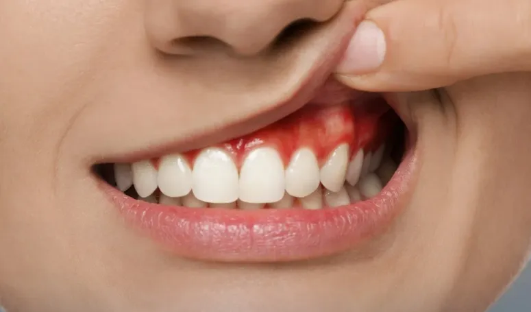 periodontia