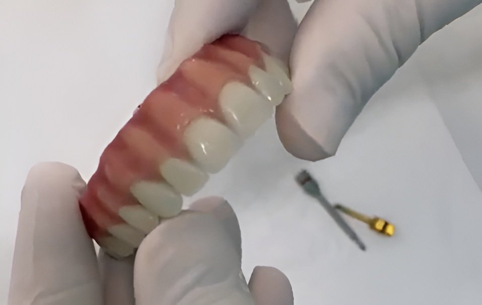 Próteses dentárias